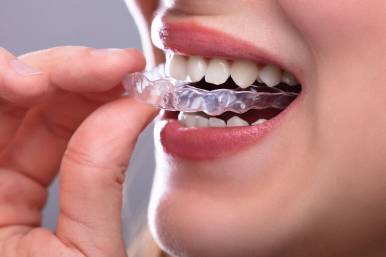 Îți scrâșnești dinții noaptea? E posibil să suferi de bruxism Îți scrâșnești dinții noaptea? E posibil să suferi de bruxism