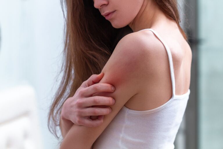Cele mai bune soluții prin care poți ține sub control dermatita atopică Cele mai bune soluții prin care poți ține sub control dermatita atopică