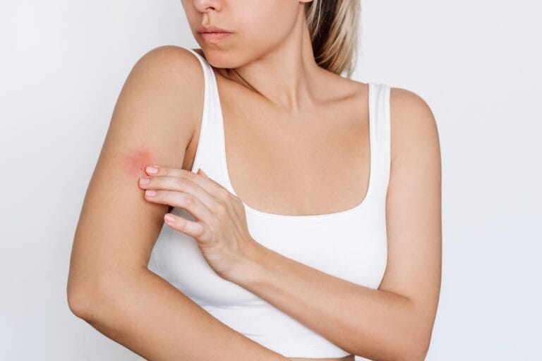 Psoriazisul în sezonul rece. Ce se întâmplă și ce remedii există? Psoriazisul în sezonul rece. Ce se întâmplă și ce remedii există?